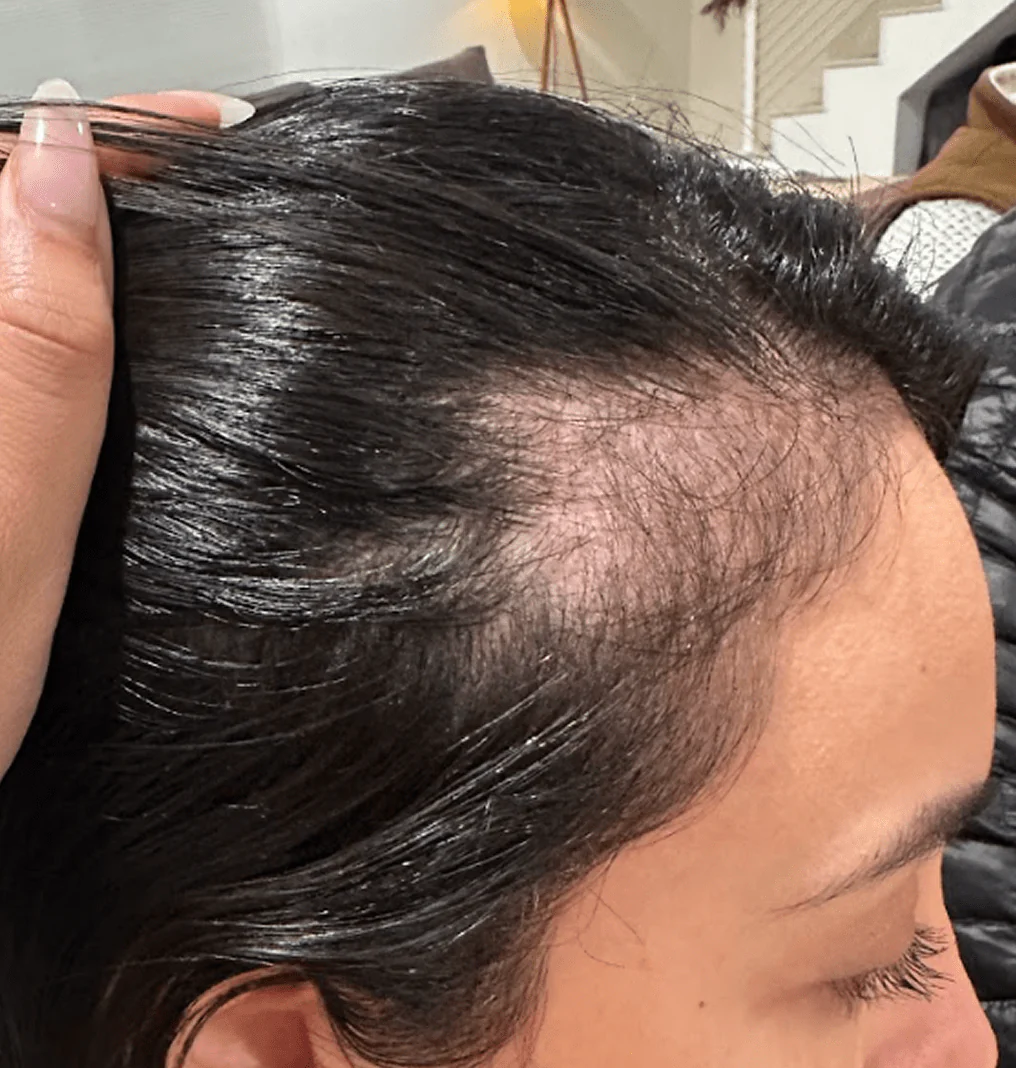Unleash Your Hair's Miracle Growth